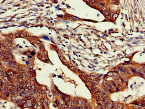 ZNF816 Antibody PACO52290