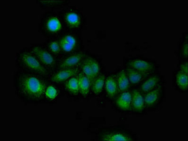 RCAN2 Antibody PACO52330