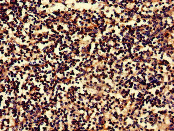 BLNK Antibody PACO52626