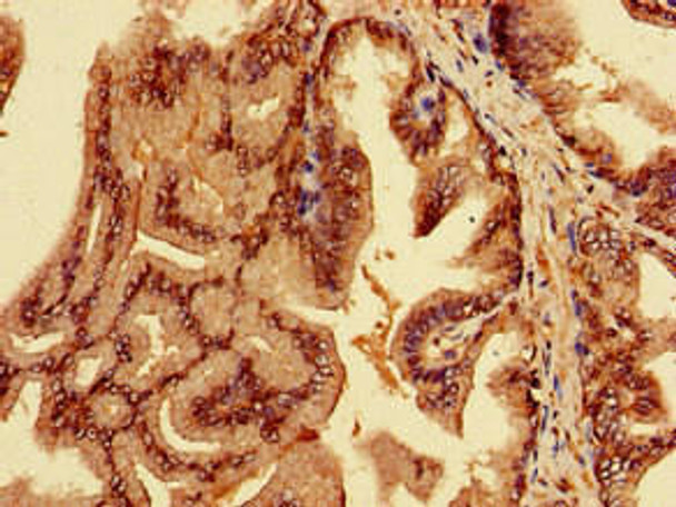 EPN3 Antibody PACO53178