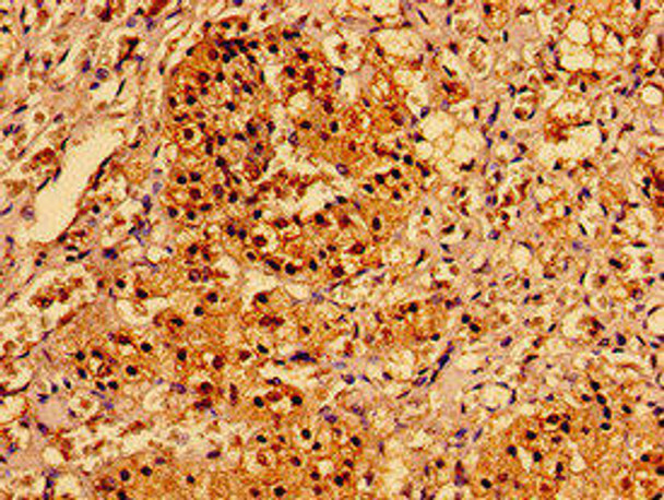 AAGAB Antibody PACO54134