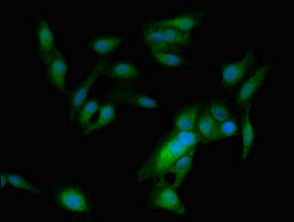 ASPM Antibody PACO54138