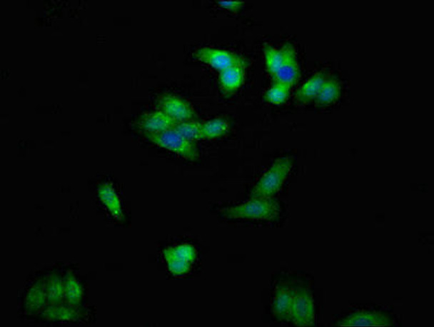 ENPP1 Antibody PACO54282