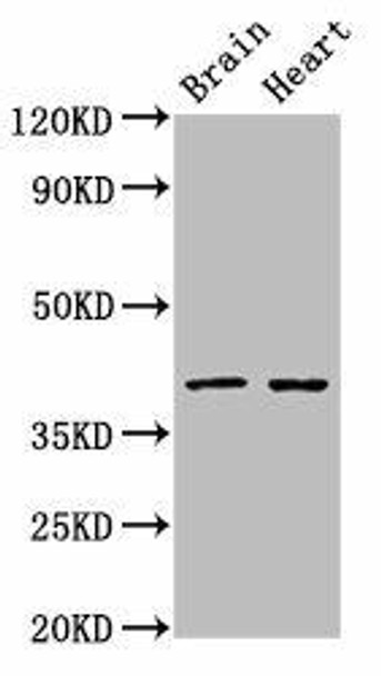 CERS1 Antibody PACO54854