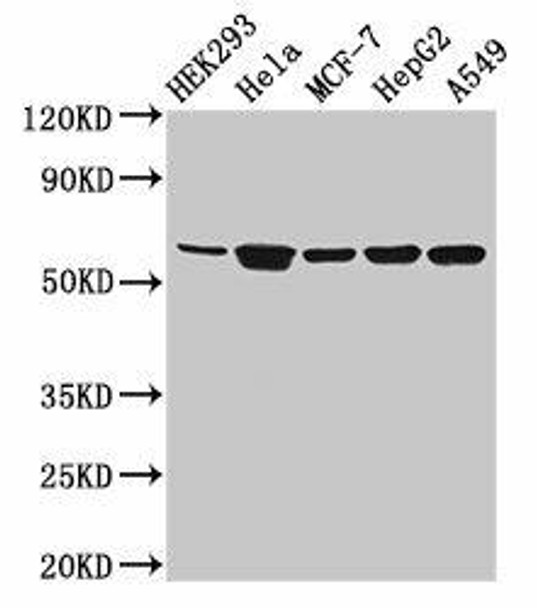 CYP4F22 Antibody PACO55174