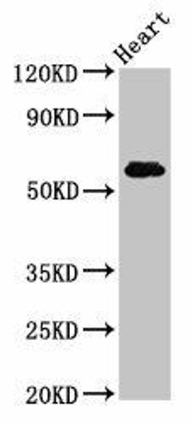 SLC11A1 Antibody PACO55778