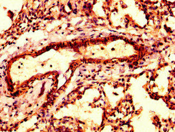 ARPC4 Antibody PACO56318