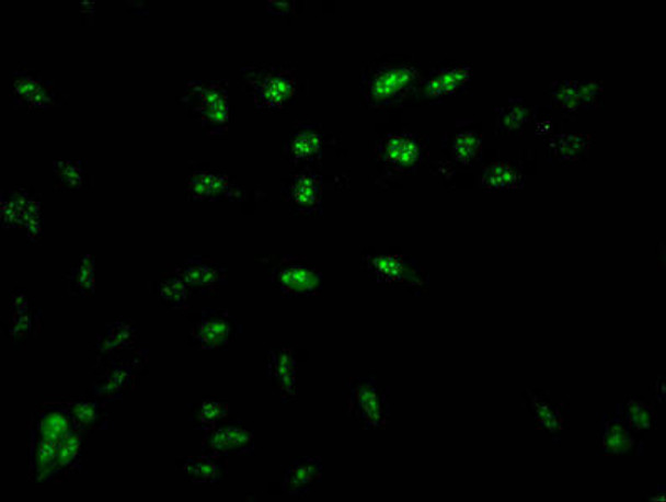 HIST1H1D Ab-16 Antibody PACO56589