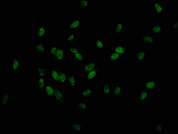 Phospho-HIST1H1D T179 Antibody PACO56708