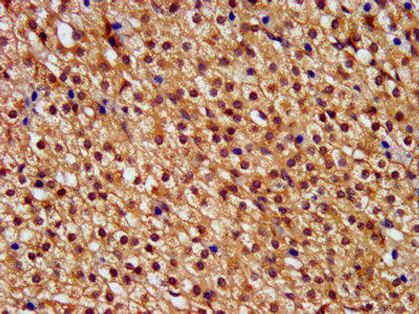 PNPLA8 Antibody PACO57472