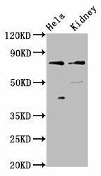 CLCNKB Antibody PACO57704