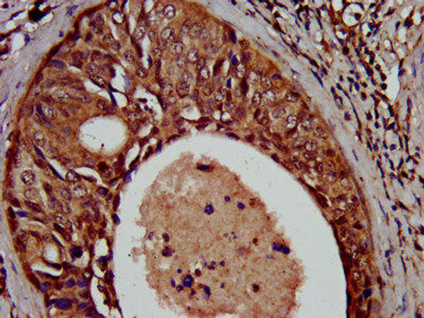 SCN11A Antibody PACO58568