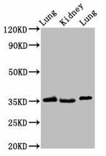 HOXD1 Antibody PACO58576