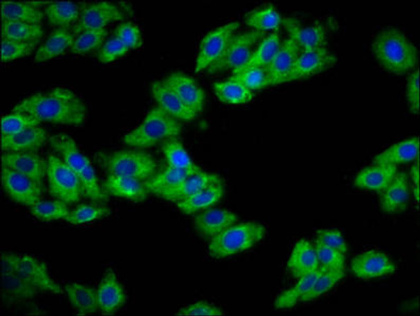 REM1 Antibody PACO58865