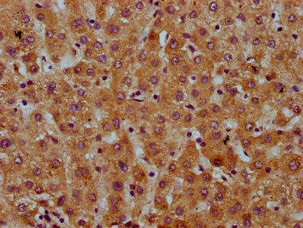 SAA2 Antibody PACO58885