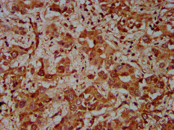 CUL7 Antibody PACO59045