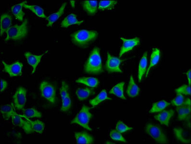 TMEM88 Antibody PACO59920