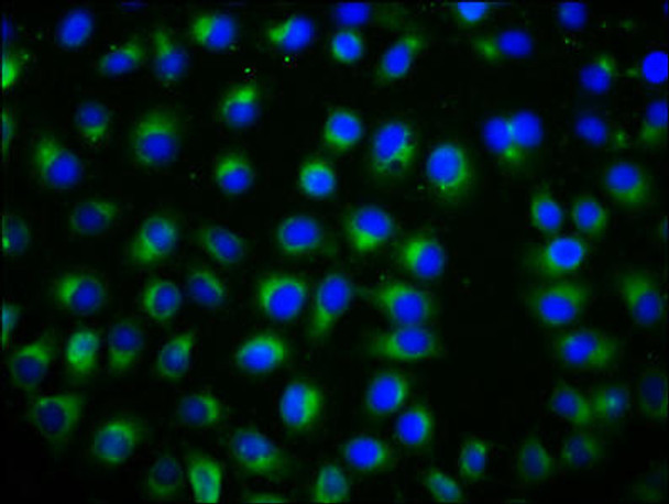 TSPAN12 Antibody PACO59928