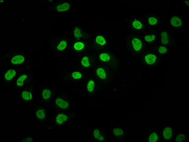 HIST1H2BC Ab-11 Antibody PACO60476