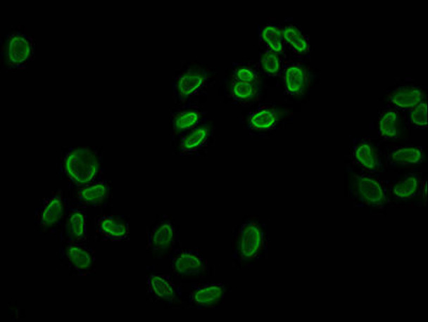 Acetyl-HIST1H2BC K12 Antibody PACO60491