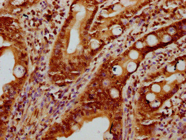 HIST1H2BC Ab-11 Antibody PACO60500