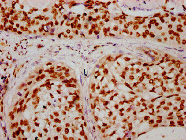 HIST1H2BC Ab-16 Antibody PACO60504