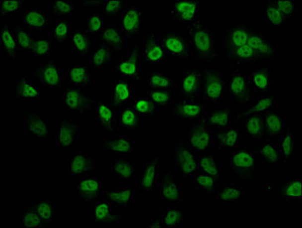 2-hydroxyisobutyryl-HIST1H2BC K24 Antibody PACO60544