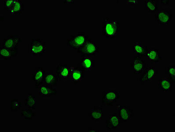 HIST1H1D Ab-90 Antibody PACO60614