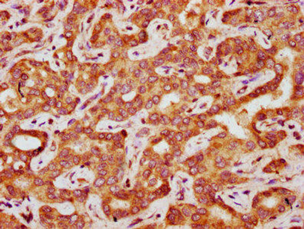 FAU Antibody PACO60697