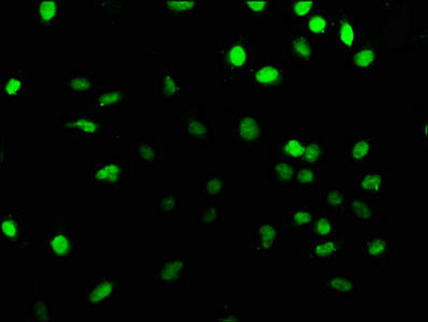 PRPF39 Antibody PACO61638