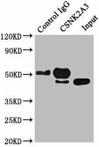 CSNK2A3 Antibody PACO61999