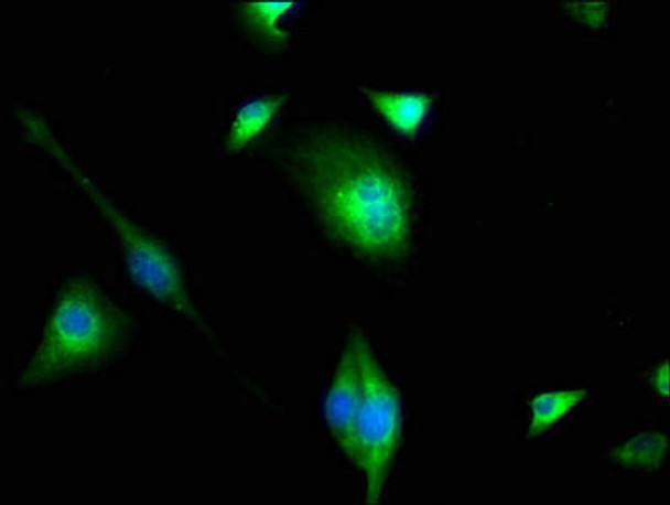 PIP4K2C Antibody PACO62767