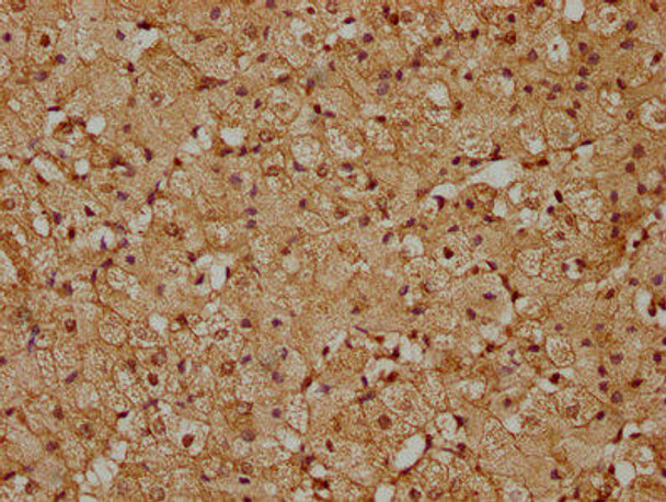 PIP4K2C Antibody PACO62767