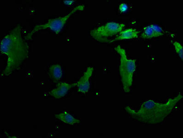 RHBDD3 Antibody PACO63403