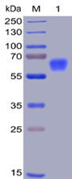 Human CD47 Recombinant Protein mFc-His Tag HDPT0008