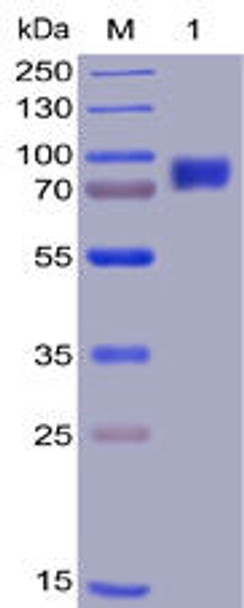 Human 2B4 Recombinant Protein mFc-His Tag HDPT0010