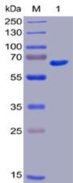 Human CD40 Recombinant Protein mFc-His Tag HDPT0015
