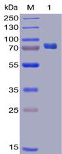 Human PD-L1 Recombinant Protein mFc-His Tag HDPT0023