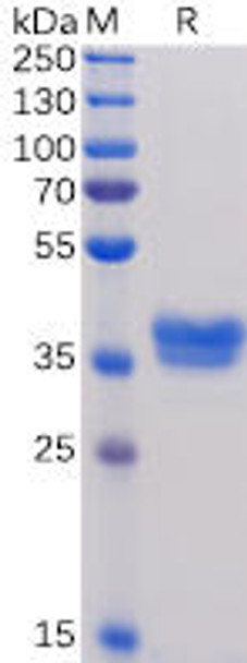 Human BCMA Recombinant Protein mFc Tag HDPT0035