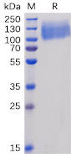 Human CEACAM5 Recombinant Protein His Tag HDPT0056