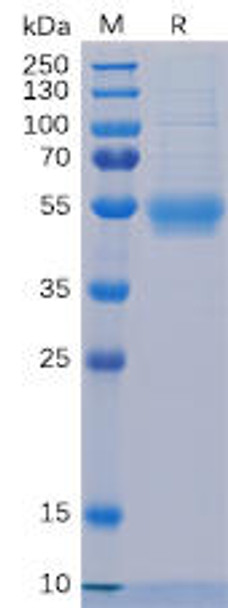 Human IL5RA Recombinant Protein His Tag HDPT0070