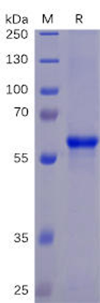 SARS-CoV-2 2019-nCoV S protein RBD, mFc-His Tag HDPT0074