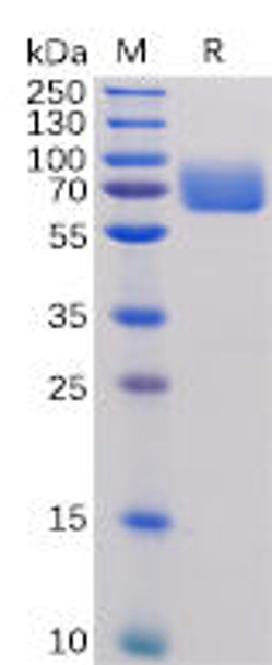 Human B7-1 Recombinant Protein hFc Tag HDPT0085