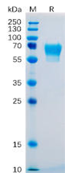 Human CD27 Recombinant Protein hFc Tag HDPT0087