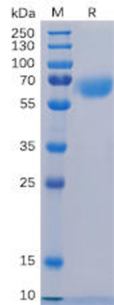 Human CD48 Recombinant Protein hFc Tag HDPT0088