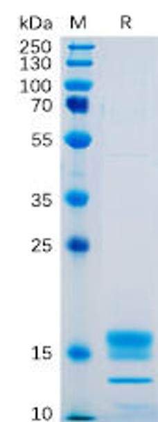 Human GITR Ligand Recombinant Protein His Tag HDPT0090