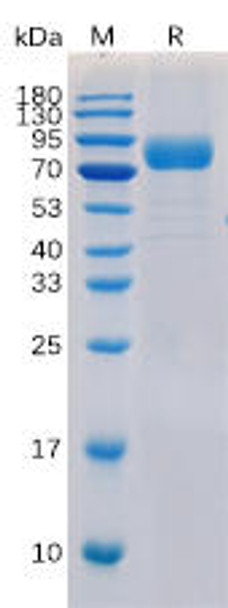 Human CD19 Recombinant Protein hFc-His Tag HDPT0111