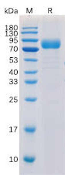 Human CD52 Recombinant Protein mFc Tag HDPT0112