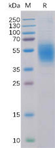 Human CLEC12A Recombinant Protein His Tag HDPT0115