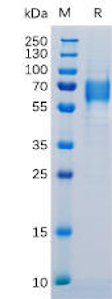 Human IL6R Recombinant Protein His Tag HDPT0125